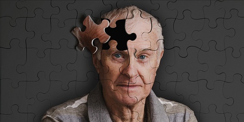 研究：阿尔茨海默症找到诊断新方法