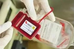 山东省脐血库|全球已有超过5万例脐带血移植，脐带血未来的前途不可限量！