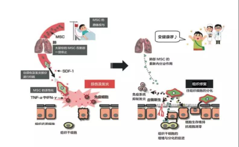 李兰娟院士：对新冠肺炎危重症患者的抢救，将配合应用干细胞