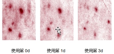 “战痘”多年，汝新美肌胶原蛋白安瓶精华面膜会是终结者？