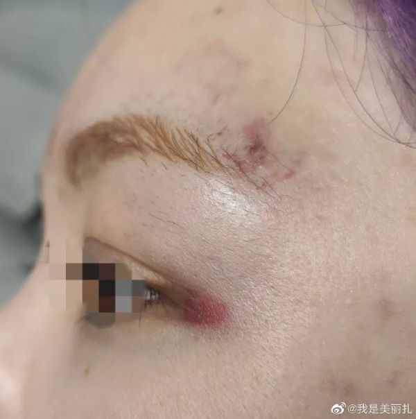 山东泰山队前球员成源辱骂、殴打女生被行拘10日，拒绝公开道歉