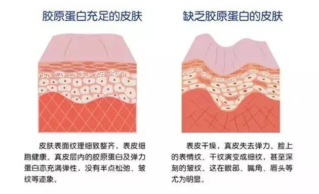 实力抗衰老，莎蔓莉莎高人气项目——四重胶原蛋白还原美丽年轻容颜