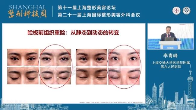 让“双眼皮手术”进入动态时代，美吉拉整形外科总监刘志刚荣获“2021年度整形美容科技十大进展”奖