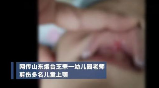 烟台金凤幼儿园教工“剪破多名儿童上颚”？警方通报：网传不实