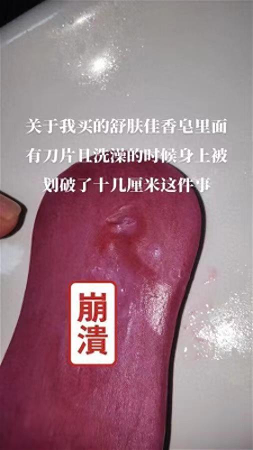 一个月两起！舒肤佳香皂里面含刀片划伤消费者？舒肤佳回应……