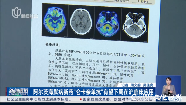 对抗老年痴呆症新药获批，有望下周在沪投入临床！年治疗费用约18-20万